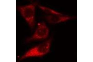 ABIN6275494 staining Hela cells by IF/ICC. (ARHGEF10 anticorps  (Internal Region))