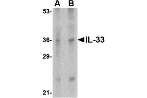 Western blot analysis of IL-33 in human lymph node tissue lysate with AP30427PU-N IL-33 antibody at (A) 1 and (B) 2 μg/ml. (IL-33 anticorps  (Center))
