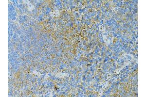 Immunohistochemistry of paraffin-embedded mouse slpeen using TLR4 antibody (ABIN5975781) at dilution of 1/100 (40x lens). (TLR4 anticorps)
