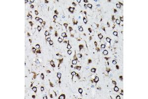 Immunohistochemistry of paraffin-embedded rat brain using RPL23A Rabbit pAb (ABIN1682576, ABIN3018519, ABIN3018520 and ABIN6220494) at dilution of 1:100 (40x lens).