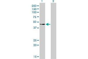 Western Blot analysis of CSK expression in transfected 293T cell line by CSK monoclonal antibody (M01), clone 3A3.