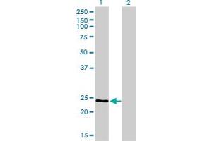 Western Blot analysis of RAB7L1 expression in transfected 293T cell line by RAB7L1 monoclonal antibody (M03), clone 2B8.
