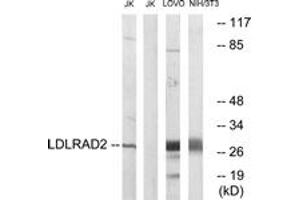 Western blot analysis of extracts from Jurkat/LOVO/NIH-3T3 cells, using LDLRAD2 Antibody. (LDLRAD2 anticorps  (AA 130-179))