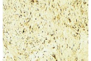 ABIN6276560 at 1/100 staining Mouse muscle tissue by IHC-P. (Tropomyosin anticorps  (N-Term))