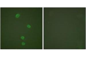 Immunofluorescence analysis of HepG2 cells, using MCM5 Antibody. (MCM5 anticorps  (AA 21-70))