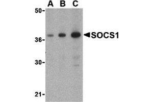 Western Blotting (WB) image for anti-Suppressor of Cytokine Signaling 1 (SOCS1) (C-Term) antibody (ABIN1030688) (SOCS1 anticorps  (C-Term))