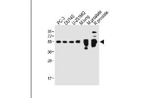 All lanes : Anti-AC Antibody (C-term) at 1:500 dilution Lane 1: PC-3 whole cell lysate Lane 2: D whole cell lysate Lane 3: U-251MG whole cell lysate Lane 4: Mouse lung whole tissue lysate Lane 5: Mouse prostate whole tissue lysate Lane 5: Rat prostate whole tissue lysate Lysates/proteins at 20 μg per lane. (ACPP anticorps  (C-Term))