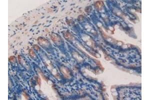 IHC-P analysis of Mouse Kidney Tissue, with DAB staining. (Galectin 9 anticorps  (AA 225-353))