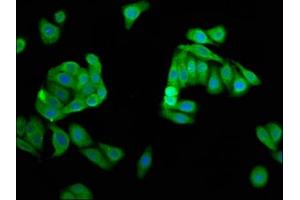 Immunofluorescence staining of HepG2 cells with ABIN7149816 at 1:66, counter-stained with DAPI. (DPPA5 anticorps  (AA 1-116))