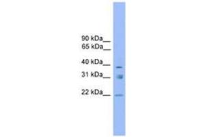 Image no. 1 for anti-Ring Finger Protein 167 (RNF167) (AA 179-228) antibody (ABIN6744738) (RNF167 anticorps  (AA 179-228))