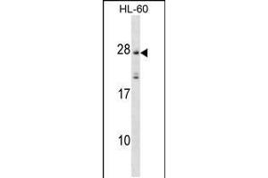 Western blot analysis in HL-60 cell line lysates (35ug/lane). (MS4A5 anticorps  (N-Term))