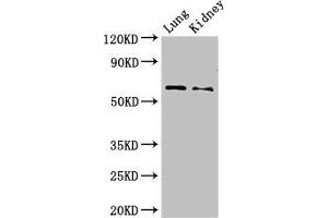 Western Blot Positive WB detected in: Mouse lung tissue, Mouse kidney tissue All lanes: Plbd2 antibody at 3 μg/mL Secondary Goat polyclonal to rabbit IgG at 1/50000 dilution Predicted band size: 66 kDa Observed band size: 66 kDa (PLBD2 anticorps  (AA 36-585))