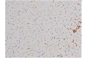 ABIN6267466 at 1/200 staining Mouse heart tissue sections by IHC-P.