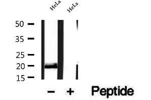 Western blot analysis of extracts of HeLa cells, using OPA3 antibody. (OPA3 anticorps  (Internal Region))