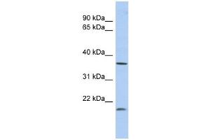MTHFD2L antibody used at 1 ug/ml to detect target protein. (MTHFD2L anticorps)