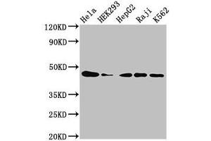 Western Blot Positive WB detected in: Hela whole cell lysate, HEK293 whole cell lysate, HepG2 whole cell lysate, Raji whole cell lysate, K562 whole cell lysate All lanes: CSNK2A1 antibody at 3 μg/mL Secondary Goat polyclonal to rabbit IgG at 1/50000 dilution Predicted band size: 46, 30 kDa Observed band size: 46 kDa (CSNK2A1/CK II alpha anticorps  (AA 1-391))