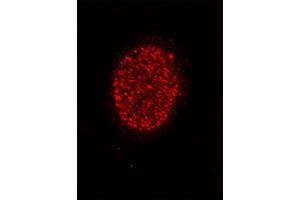 Histone H4 acetyl Lys5 antibody tested by immunofluorescence. (Histone H4 anticorps  (acLys5))