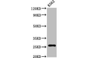 Western Blot Positive WB detected in:K562 whole cell lysate All lanes:CD81 antibody at 1. (Recombinant CD81 anticorps)