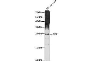 Western blot analysis of extracts of mouse brain, using PIGP antibody (ABIN6292034) at 1:1000 dilution.