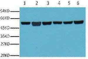 Western Blot (WB) analysis of A549 (1), Rat Brain (2), Mouse Brain (3), Chicken lung (4) and Rabbit testis (5), Sheep muscle (6), diluted at 1:5000.