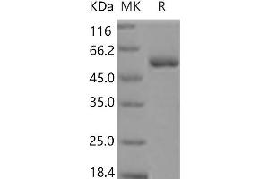 Western Blotting (WB) image for Myeloproliferative Leukemia Virus Oncogene (MPL) protein (His tag) (ABIN7321113)