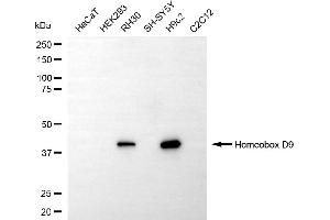 anti-Homeobox D9 (HOXD9) antibody