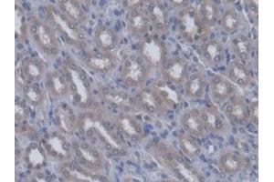 IHC-P analysis of Rat Kidney Tissue, with DAB staining. (QARS anticorps  (AA 2-206))