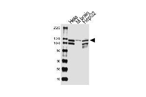 Western blot analysis of lysates from Hela cell line, mouse brain tissue lysate, HepG2 cell line (from left to right), using UBE3CAntibody (Center) (ABIN1881969 and ABIN2843383). (UBE3C anticorps  (AA 549-578))