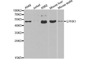 Western blot analysis of extracts of various cell lines, using EPHX1 antibody. (EPHX1 anticorps)