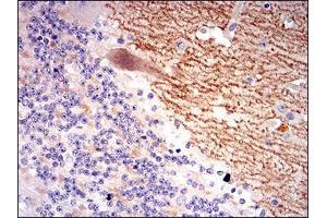 Immunohistochemical analysis of paraffin-embedded cerebellum tissues using GABBR2 mouse mAb with DAB staining.