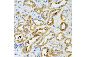 Immunohistochemistry of paraffin-embedded rat kidney using SIRT3 antibody (ABIN2559929) at dilution of 1:100 (40x lens). (SIRT3 anticorps)