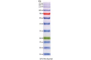 SDS-PAGE (SDS) image for ExcelBand™ Enhanced 3-color High Range Protein Marker (ABIN5662609) (ExcelBand™ Enhanced 3-color High Range Protein Marker)