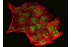 IF analysis of SnoN/SNO/SKIL using anti-SnoN/SNO/SKIL antibody (ABIN7599455). (SKIL anticorps  (AA 1-504))