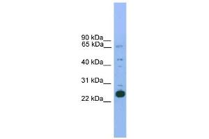 WB Suggested Anti-Nkx2-6 Antibody Titration: 0. (NKX2-6 anticorps  (N-Term))