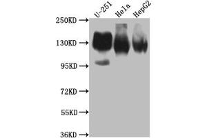 Western Blot Positive WB detected in: U-251 whole cell lysate, Hela whole cell lysate, HepG2 whole cell lysate All lanes: ITGAV antibody at 1:1000 Secondary Goat polyclonal to rabbit IgG at 1/50000 dilution Predicted band size: 117, 113, 112 kDa Observed band size: 130 kDa (Recombinant CD51 anticorps)