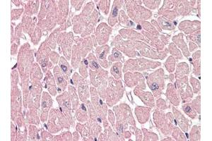 Human Heart (formalin-fixed, paraffin-embedded) stained with ARHGEF17 antibody LAP22665PU-N at 5 µg/ml followed by biotinylated goat anti-rabbit IgG secondary antibody, alkaline phosphatase-streptavidin and chromogen. (ARHGEF17 anticorps)