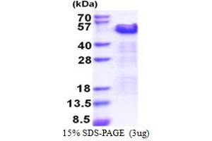 Thyroid Hormone Receptor Interactor 10 (TRIP10) (AA 260-545) protein (His tag)