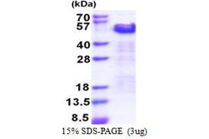 SDS-PAGE (SDS) image for Thyroid Hormone Receptor Interactor 10 (TRIP10) (AA 260-545) protein (His tag) (ABIN5853438) (TRIP10 Protein (AA 260-545) (His tag))