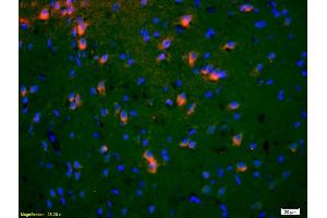 Formalin-fixed and paraffin-embedded rat brain labeled with Anti-EphA5/Eph receptor A5 Polyclonal Antibody, Unconjugated (ABIN718661) 1:200, overnight at 4°C, The secondary antibody was Goat Anti-Rabbit IgG, Cy3 conjugated used at 1:200 dilution for 40 minutes at 37°C. (EPH Receptor A5 anticorps  (AA 451-550))