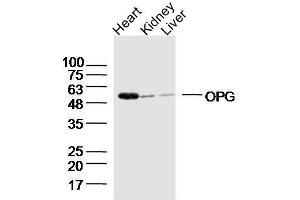 Lane 1: Mouse heart lysates, Lane 2: Mouse kidney lysates, Lane 3: Mouse liver lysates probed with OPG Polyclonal Antibody  at 1:300 overnight at 4˚C.