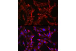 Immunofluorescence analysis of C6 cells using TMPRSS2 Rabbit pAb (ABIN6132728, ABIN6149286, ABIN6149287 and ABIN6219138) at dilution of 1:50 (40x lens). (TMPRSS2 anticorps  (AA 140-400))