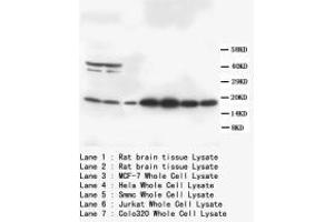 Image no. 1 for anti-S100 Calcium Binding Protein B (S100B) (C-Term) antibody (ABIN1493108)