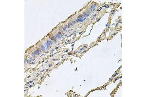 Immunohistochemistry of paraffin-embedded human trachea using FABP12 antibody (ABIN6003626) at dilution of 1/100 (40x lens). (FABP12 anticorps)