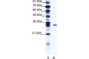 WB Suggested Anti-KCNIP4 Antibody   Titration: 1.