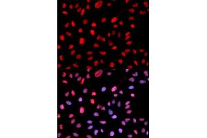 Immunofluorescence analysis of MCF7 cell using Phospho-Dnmt1-pS714 antibody. (DNMT1 anticorps  (pSer714))