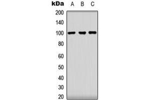 Western blot analysis of CLOCK expression in HeLa (A), HEK293T (B), NIH3T3 (C) whole cell lysates. (CLOCK anticorps  (Center))