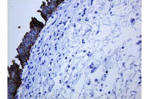 Image no. 5 for anti-Keratin 5 (KRT5) (AA 1-273) antibody (ABIN1490696)