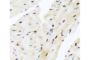Immunohistochemistry of paraffin-embedded Mouse heart using ZBTB17 Polyclonal Antibody at dilution of 1:100 (40x lens). (ZBTB17 anticorps)