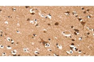 Immunohistochemistry of paraffin-embedded Human brain using DAAM1 Polyclonal Antibody at dilution of 1:50 (DAAM1 anticorps)