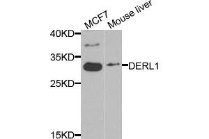 Western blot analysis of extracts of MCF7 and mouse liver cells, using DERL1 antibody.
